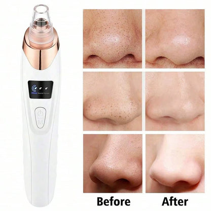 Electric Pore Cleaner & Blackhead Remover – Deep Cleansing Facial Vacuum Tool