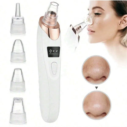 Electric Pore Cleaner & Blackhead Remover – Deep Cleansing Facial Vacuum Tool